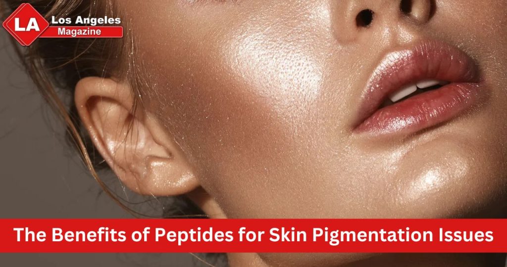 The Benefits of Peptides for Skin Pigmentation Issues