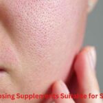 Tips for Choosing Supplements Suitable for Sensitive Skin