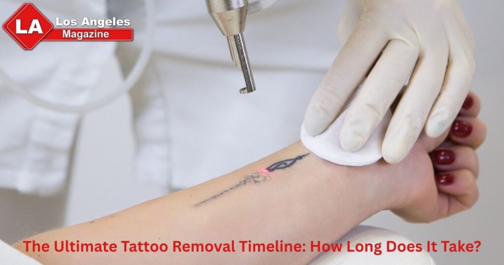 The Ultimate Tattoo Removal Timeline: How Long Does It Take?
