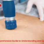 Cellulogia: A Comprehensive Guide to Understanding and Combating Cellulite