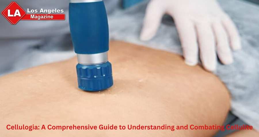 Cellulogia: A Comprehensive Guide to Understanding and Combating Cellulite Cellulogia: A Comprehensive Guide to Understanding and Combating Cellulite
