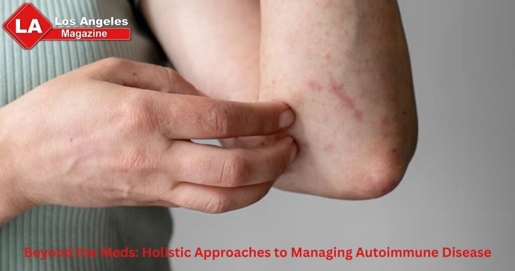 Beyond the Meds: Holistic Approaches to Managing Autoimmune Disease